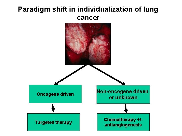 Paradigm shift in individualization of lung cancer Oncogene driven Targeted therapy Non-oncogene driven or