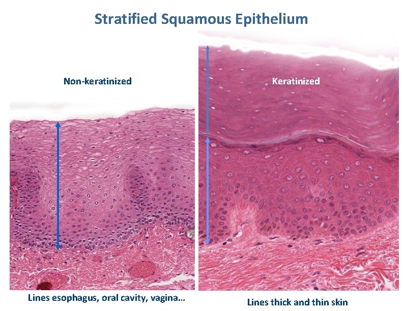 Stratified Squamous Epithelium Non-keratinized Lines esophagus, oral cavity, vagina… Keratinized Lines thick and thin