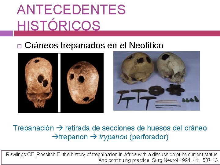 ANTECEDENTES HISTÓRICOS Cráneos trepanados en el Neolítico Trepanación retirada de secciones de huesos del