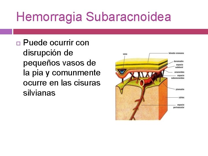 Hemorragia Subaracnoidea Puede ocurrir con disrupción de pequeños vasos de la pia y comunmente