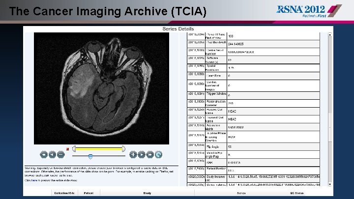 The Cancer Imaging Archive (TCIA) 