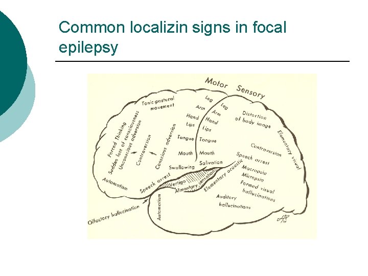 Common localizin signs in focal epilepsy 