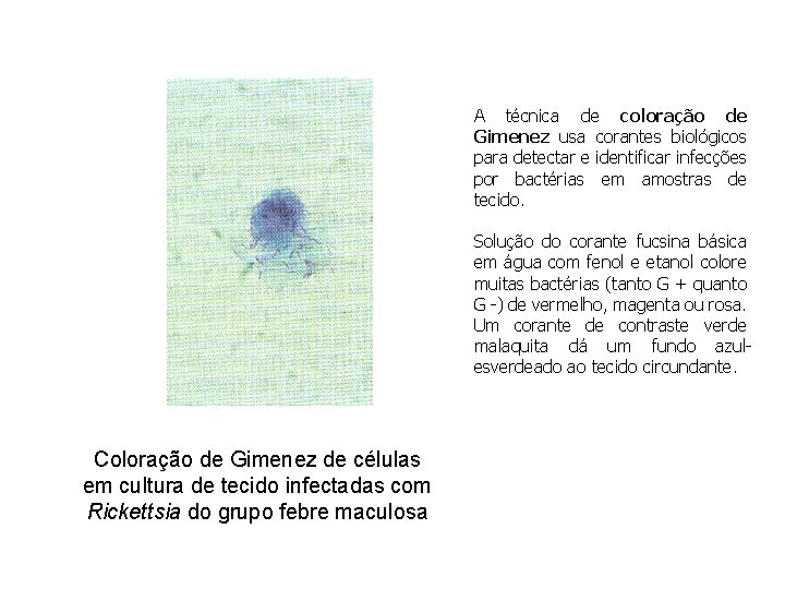 A técnica de coloração de Gimenez usa corantes biológicos para detectar e identificar infecções