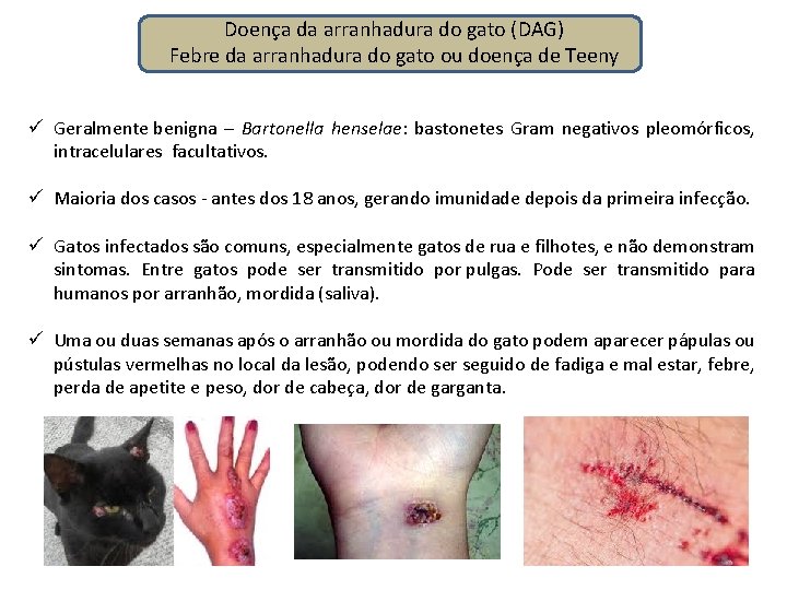 Doença da arranhadura do gato (DAG) Febre da arranhadura do gato ou doença de