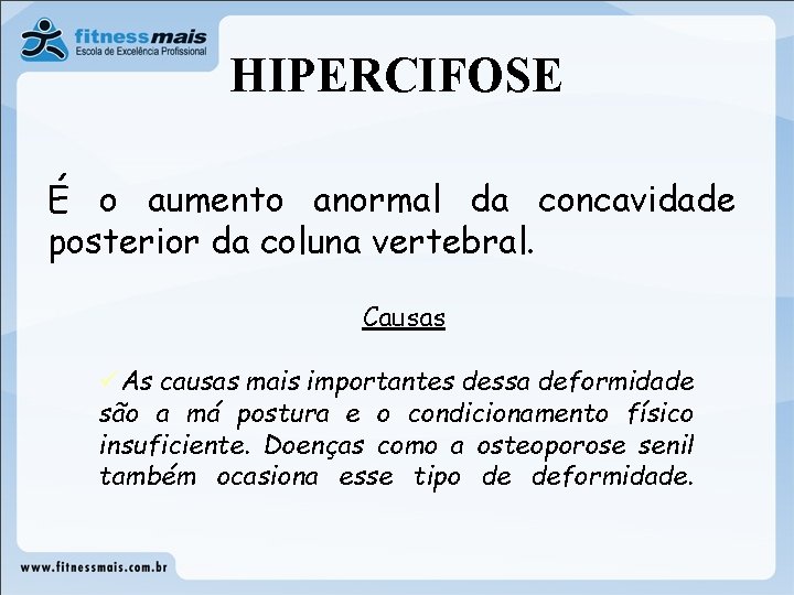HIPERCIFOSE É o aumento anormal da concavidade posterior da coluna vertebral. Causas üAs causas HIPERCIFOSE É o aumento anormal da concavidade posterior da coluna vertebral. Causas üAs causas