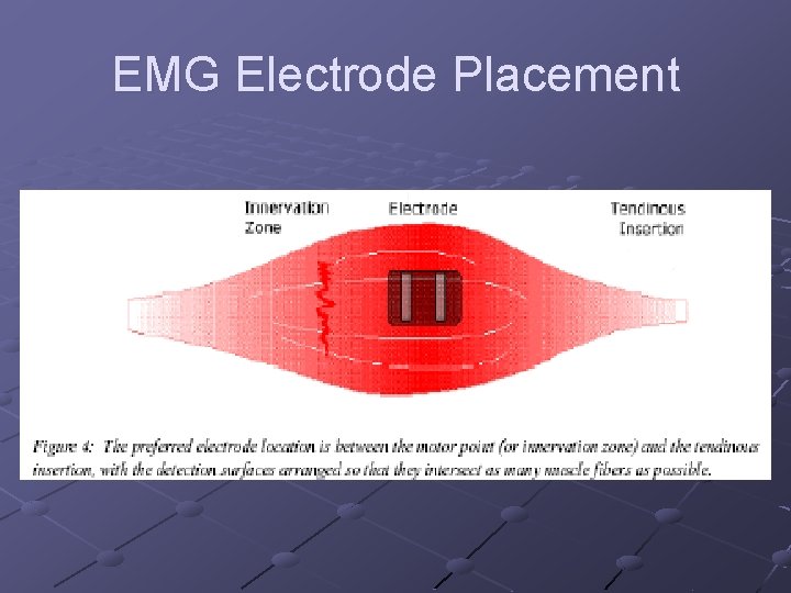 EMG Electrode Placement 