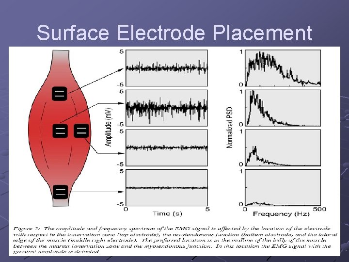Surface Electrode Placement 