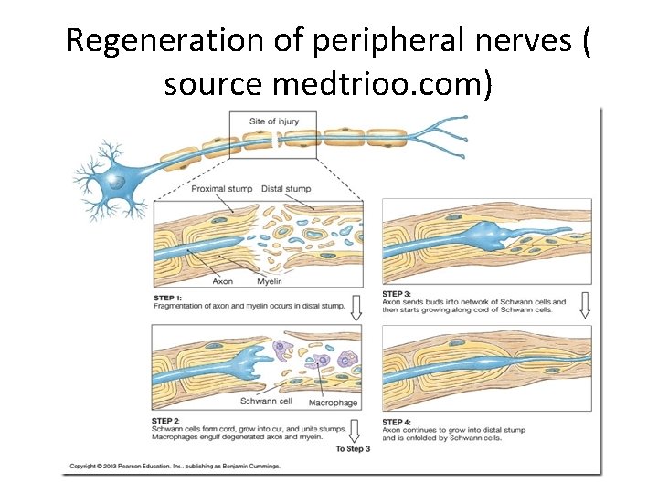 Regeneration of peripheral nerves ( source medtrioo. com) 