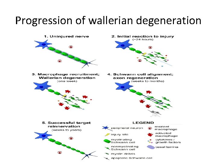 Progression of wallerian degeneration 