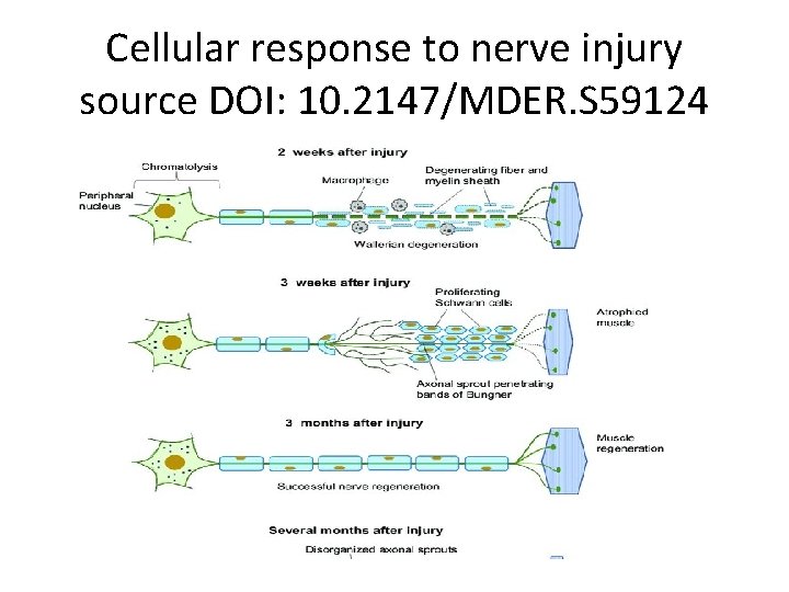 Cellular response to nerve injury source DOI: 10. 2147/MDER. S 59124 