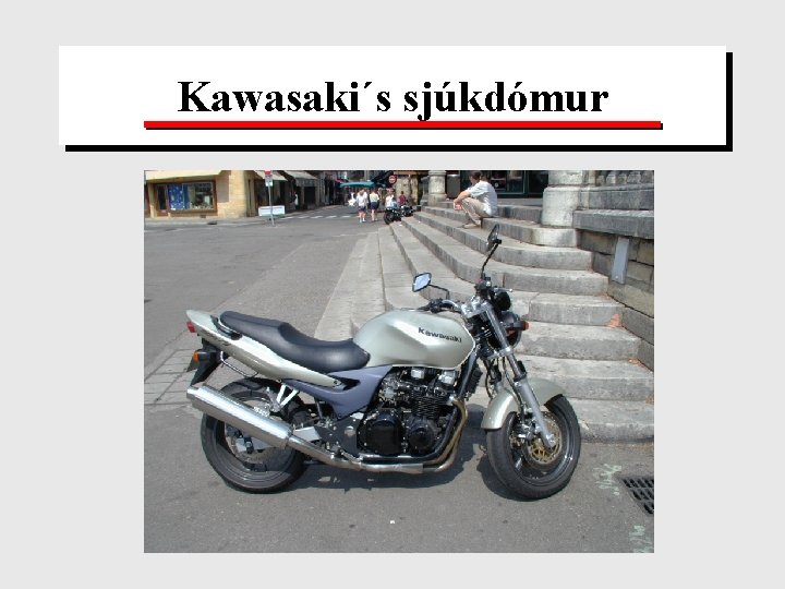 Kawasaki´s sjúkdómur 