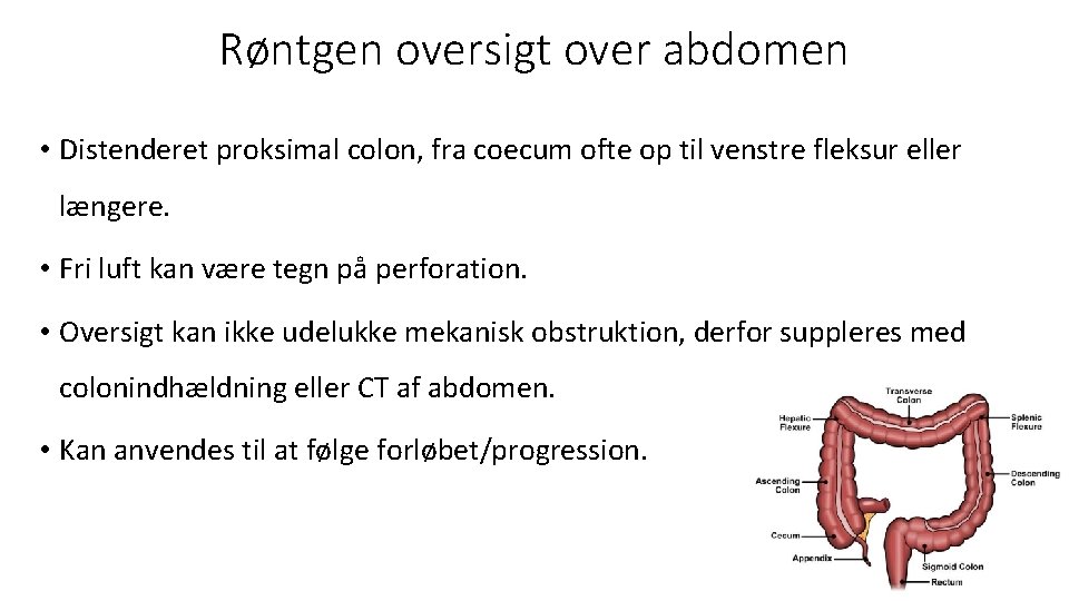 Røntgen oversigt over abdomen • Distenderet proksimal colon, fra coecum ofte op til venstre