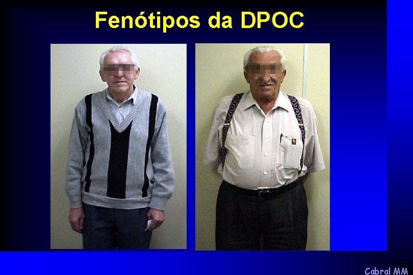 Fenótipos da DPOC Cabral MM 