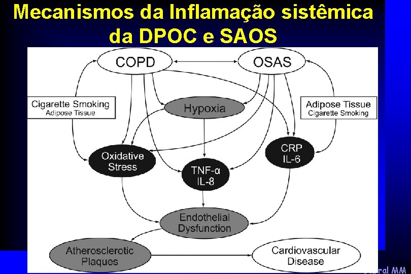 Mecanismos da Inflamação sistêmica da DPOC e SAOS Cabral MM 