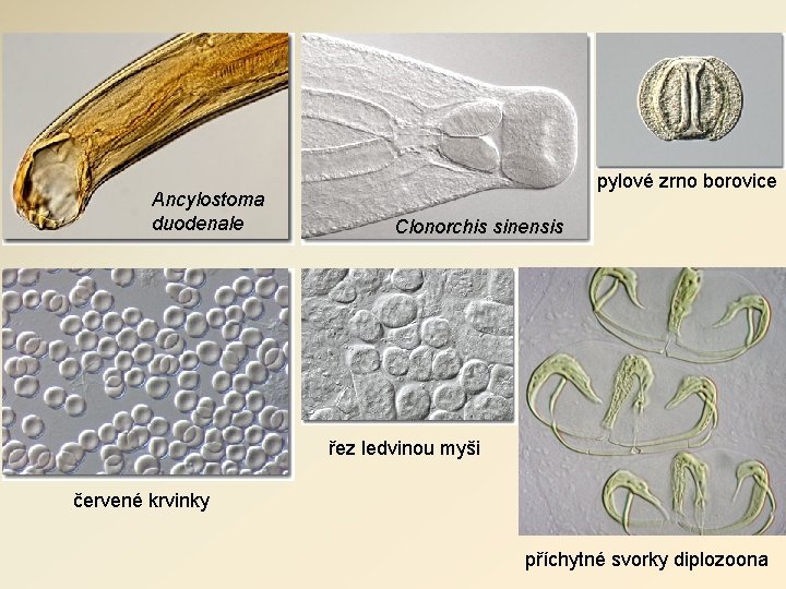 Ancylostoma duodenale pylové zrno borovice Clonorchis sinensis řez ledvinou myši červené krvinky příchytné svorky