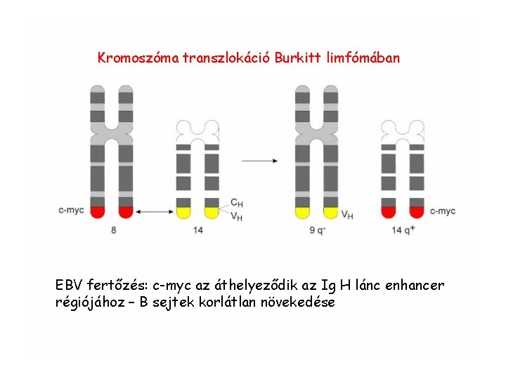 Kromoszóma transzlokáció Burkitt limfómában EBV fertőzés: c-myc az áthelyeződik az Ig H lánc enhancer Kromoszóma transzlokáció Burkitt limfómában EBV fertőzés: c-myc az áthelyeződik az Ig H lánc enhancer