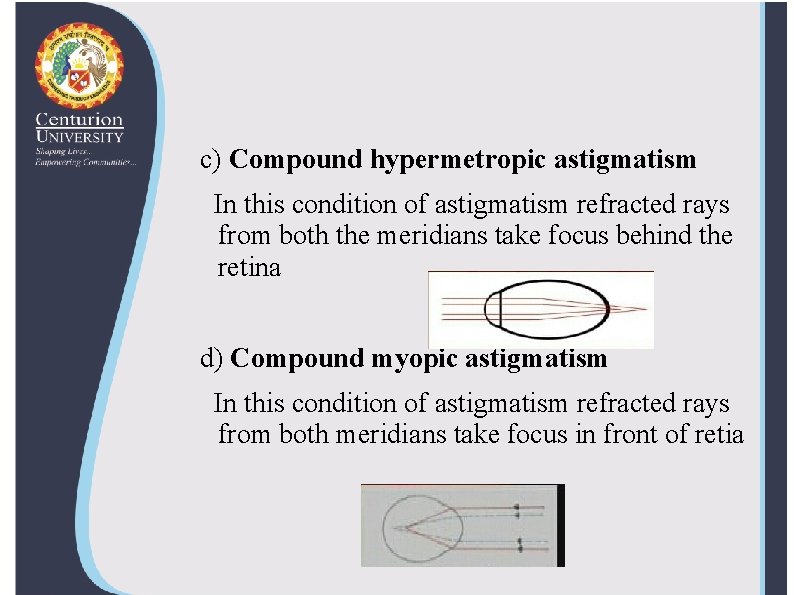 c) Compound hypermetropic astigmatism In this condition of astigmatism refracted rays from both the