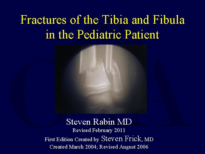 Fractures of the Tibia and Fibula in the Pediatric Patient Steven Rabin MD Revised