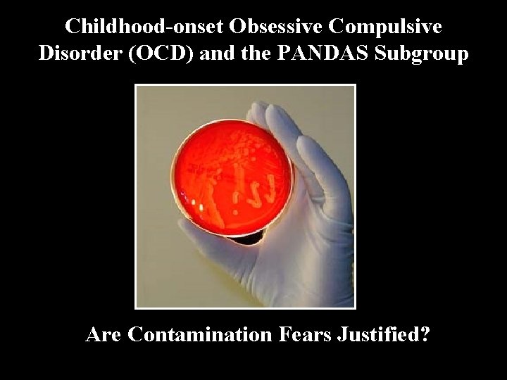 Childhood-onset Obsessive Compulsive Disorder (OCD) and the PANDAS Subgroup Are Contamination Fears Justified? 