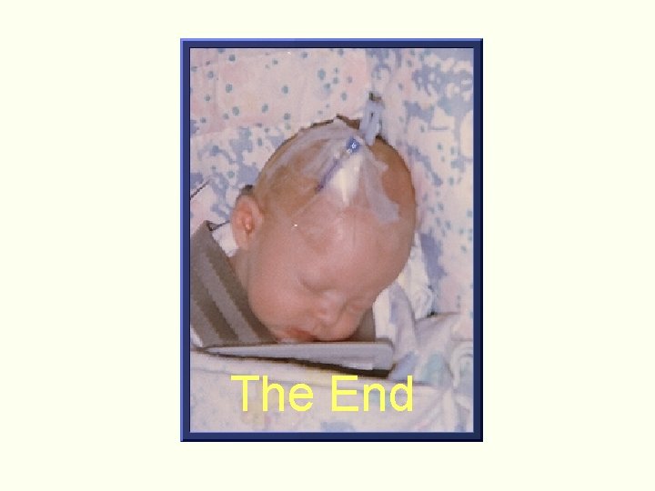 The End The End