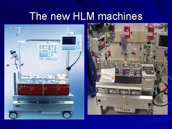 The new HLM machines 