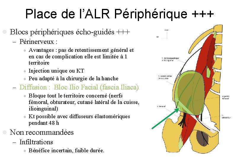 Place de l’ALR Périphérique +++ l Blocs périphériques écho-guidés +++ – Périnerveux : l Place de l’ALR Périphérique +++ l Blocs périphériques écho-guidés +++ – Périnerveux : l