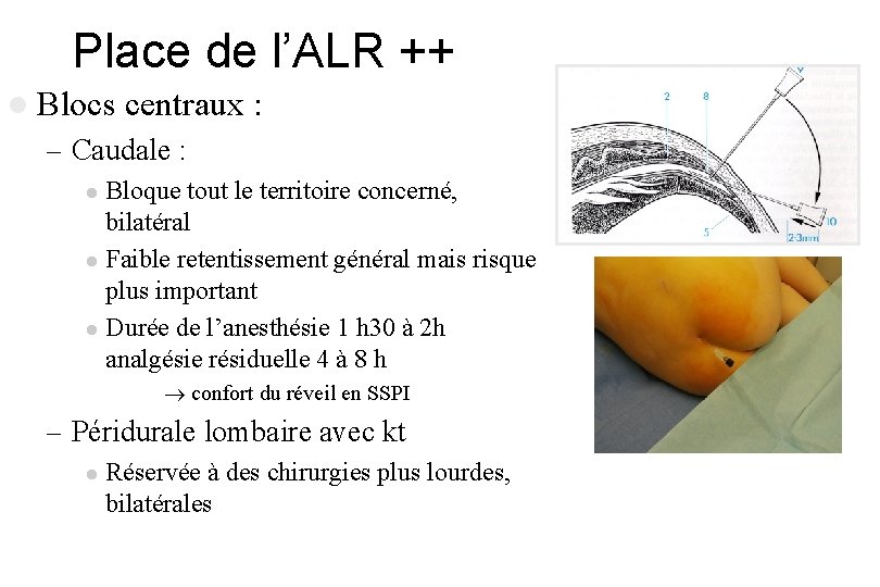 Place de l’ALR ++ l Blocs centraux : – Caudale : Bloque tout le Place de l’ALR ++ l Blocs centraux : – Caudale : Bloque tout le