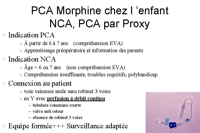 PCA Morphine chez l ’enfant NCA, PCA par Proxy l Indication PCA l l PCA Morphine chez l ’enfant NCA, PCA par Proxy l Indication PCA l l