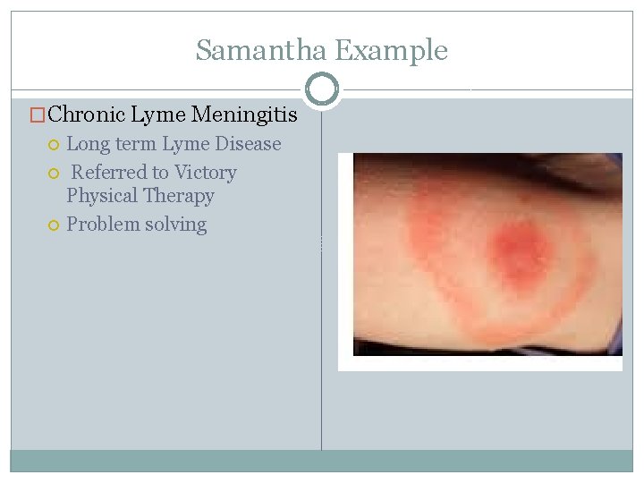 Samantha Example �Chronic Lyme Meningitis Long term Lyme Disease Referred to Victory Physical Therapy