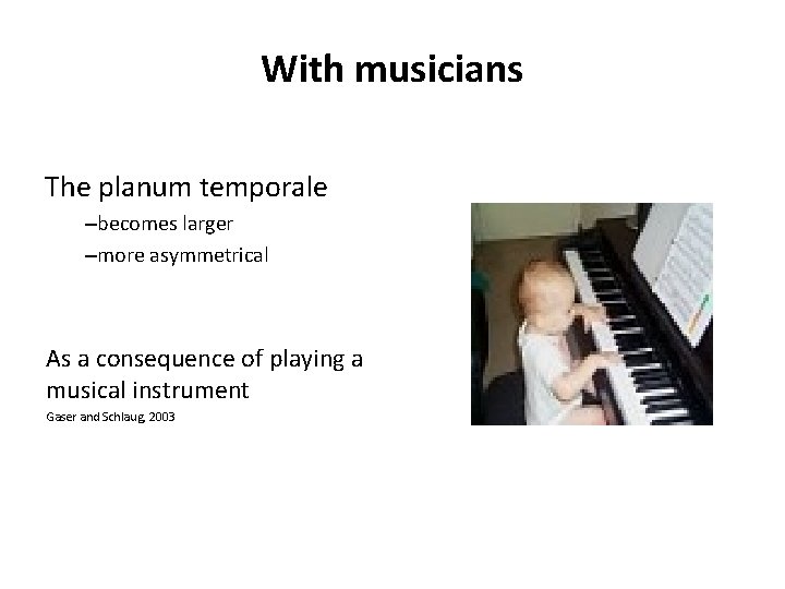 With musicians The planum temporale –becomes larger –more asymmetrical As a consequence of playing