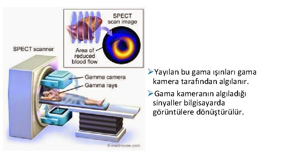 ØYayılan bu gama ışınları gama kamera tarafından algılanır. ØGama kameranın algıladığı sinyaller bilgisayarda görüntülere