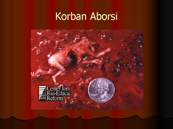 Korban Aborsi Korban Aborsi