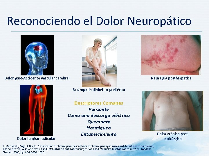 Reconociendo el Dolor Neuropático Dolor post-Accidente vascular cerebral Neuralgia postherpética Neuropatía diabética periférica Dolor