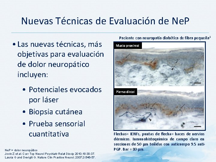 Nuevas Técnicas de Evaluación de Ne. P • Las nuevas técnicas, más objetivas para