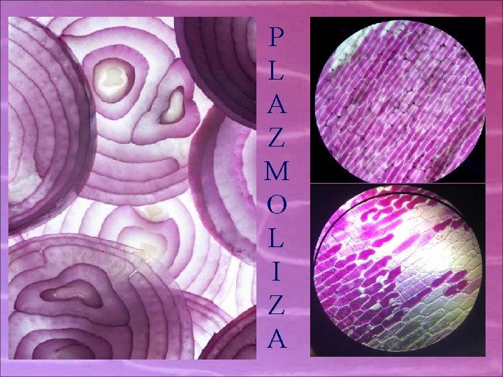 P L A Z M O L I Z A P L A Z M O L I Z A
