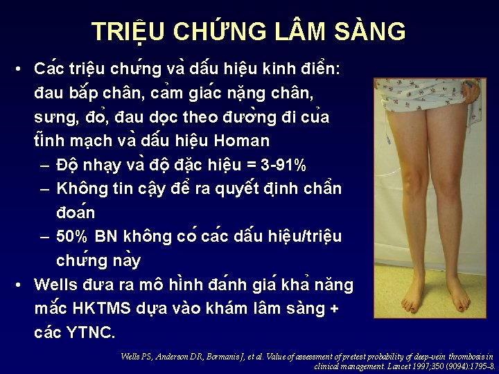 TRIỆU CHỨNG L M SÀNG • Ca c triê u chư ng va dâ