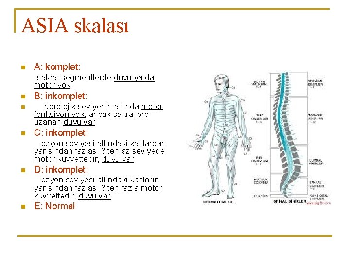 ASIA skalası n A: komplet: sakral segmentlerde duyu ya da motor yok n B: