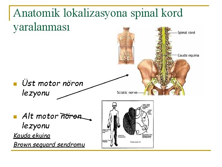 Anatomik lokalizasyona spinal kord yaralanması n n Üst motor nöron lezyonu Alt motor nöron