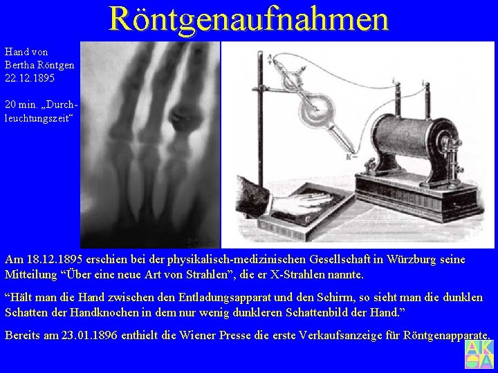 Röntgenaufnahmen Hand von Bertha Röntgen 22. 1895 20 min. „Durchleuchtungszeit“ Am 18. 12. 1895