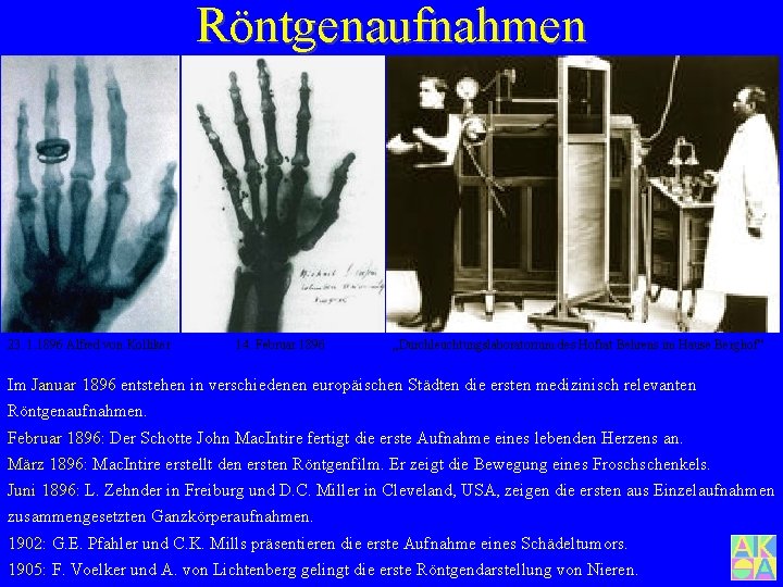 Röntgenaufnahmen 23. 1. 1896 Alfred von Kolliker 14. Februar 1896 „Durchleuchtungslaboratorium des Hofrat Behrens