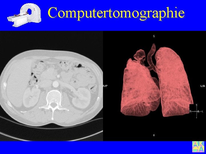 Computertomographie 