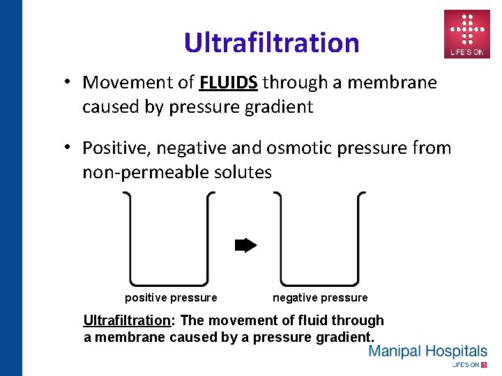 Ultrafiltration • Movement of FLUIDS through a membrane caused by pressure gradient • Positive,