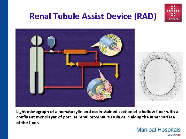 Renal Tubule Assist Device (RAD) Light micrograph of a hematoxylin and eosin stained section