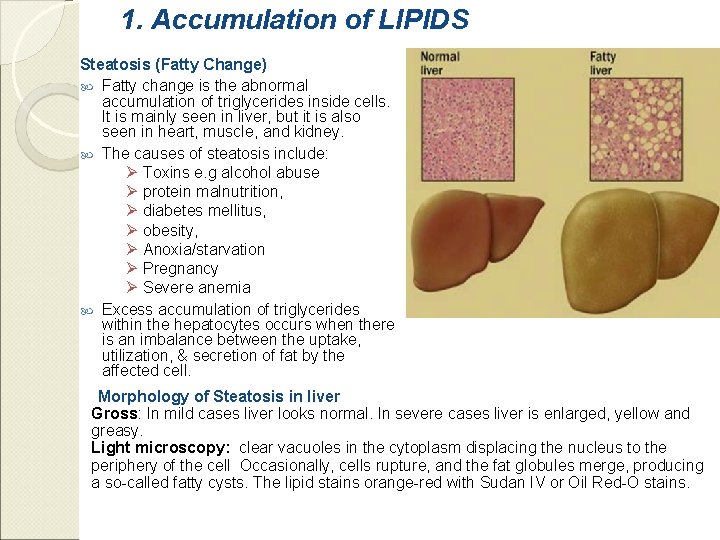 1. Accumulation of LIPIDS Steatosis (Fatty Change) Fatty change is the abnormal accumulation of