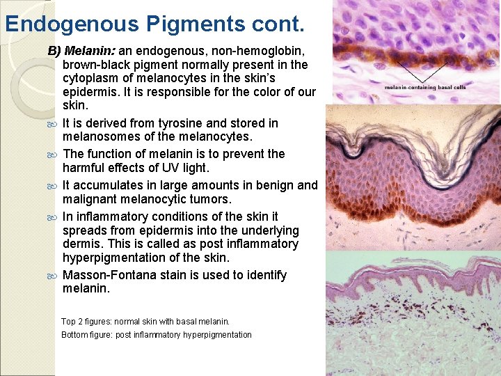 Endogenous Pigments cont. B) Melanin: an endogenous, non-hemoglobin, brown-black pigment normally present in the