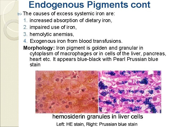 Endogenous Pigments cont The causes of excess systemic iron are: 1. increased absorption of