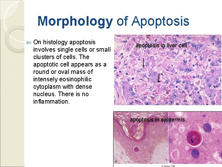 Morphology of Apoptosis On histology apoptosis involves single cells or small clusters of cells.