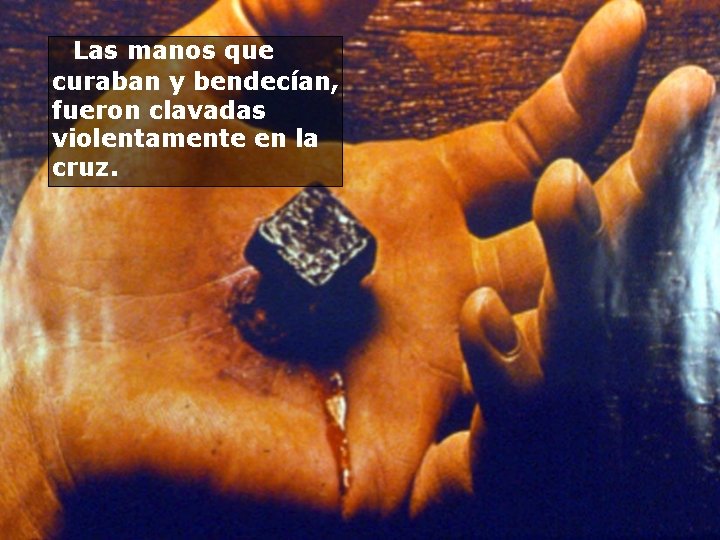  Las manos que curaban y bendecían, fueron clavadas violentamente en la cruz. 