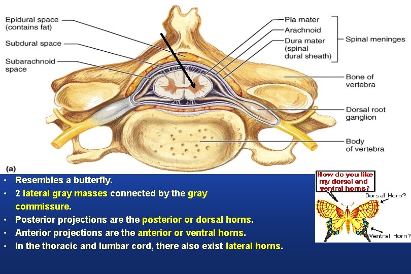  • Resembles a butterfly. • 2 lateral gray masses connected by the gray