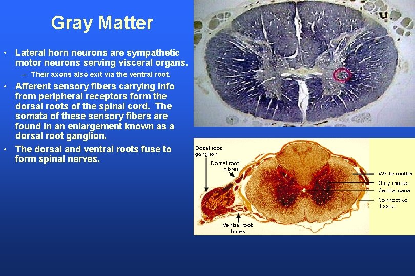 Gray Matter • Lateral horn neurons are sympathetic motor neurons serving visceral organs. –